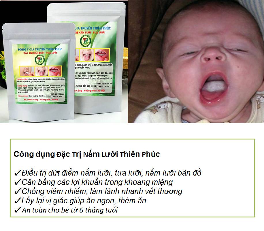 Đặc trị nấm lưỡi Thiên Phúc 